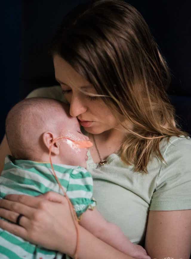 Mom Makes Plea After Shaken Baby Syndrome Almost Killed Her Daughter