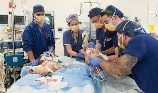 This photo provided by RCH Melbourne Creative Studio, shows surgery on the 15-month-old girls at the Royal Children's Hospital Melbourne, Australia Friday, Nov. 8.
