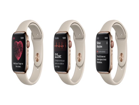 iwatch 4 cardiogram