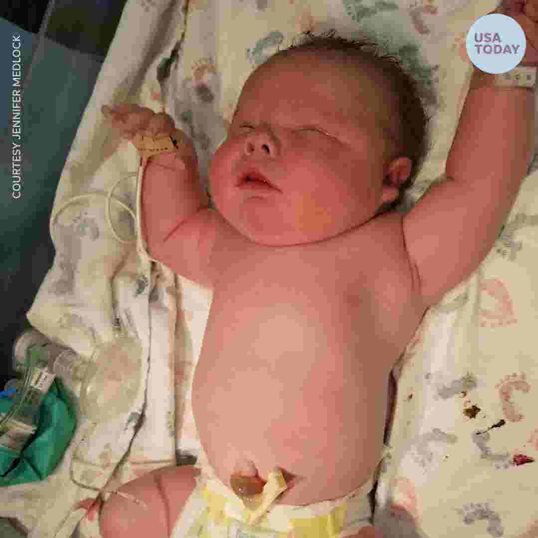 Is Having A Large Baby Safe How Do Some Babies Get So Big