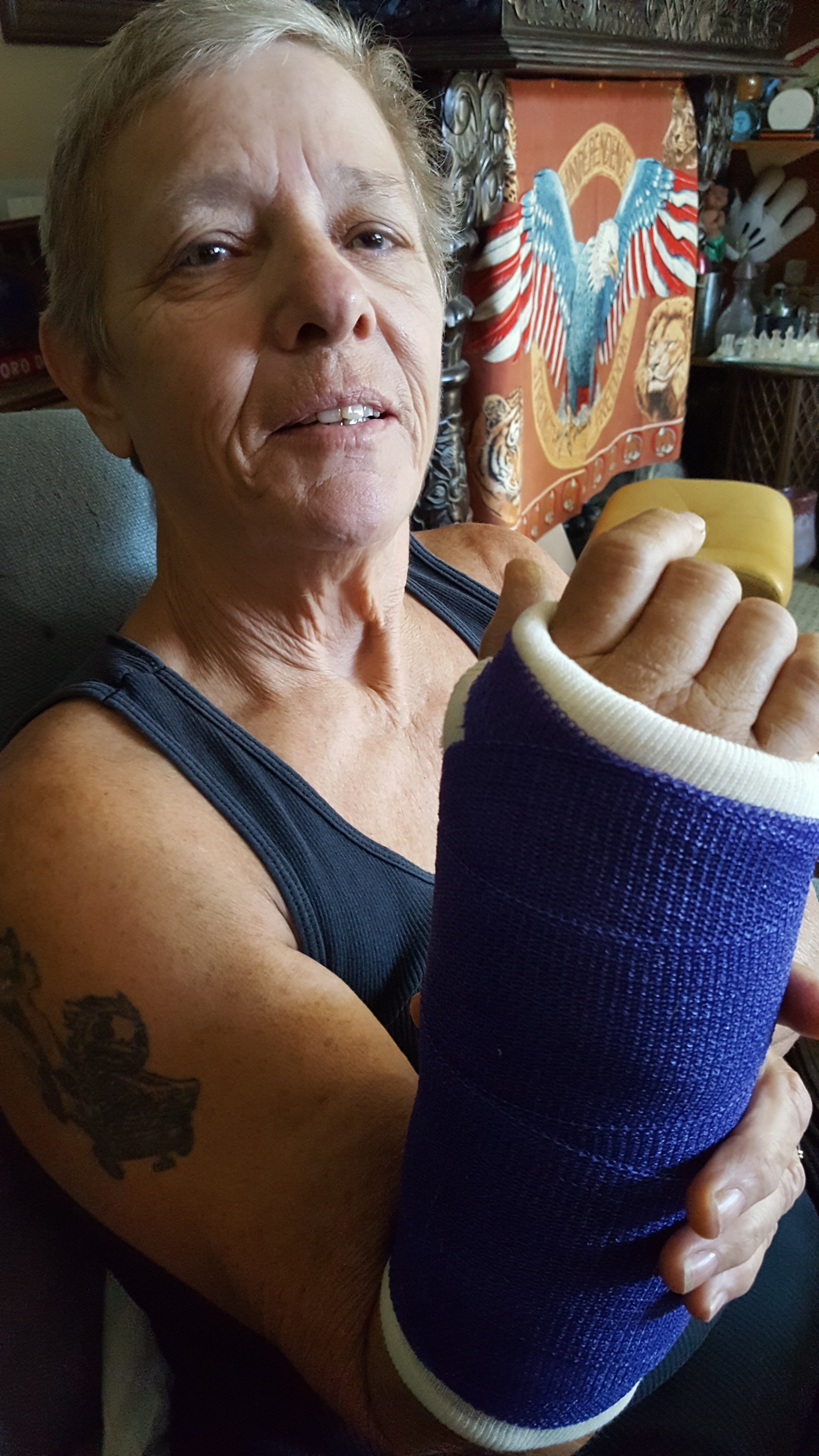 Navy veteran Phyllis Seleska says she received no medication to alleviate the pain of her broken wrist.