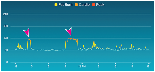 Shows sudden increase in heart rate to 110 to 120 beats/min on 2 occasions (pink arrows) for 1 to 2.5 hours each time in the absence of physical activity.