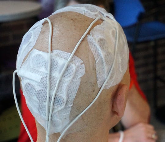 Canton man uses Optune to fight glioblastoma cancer