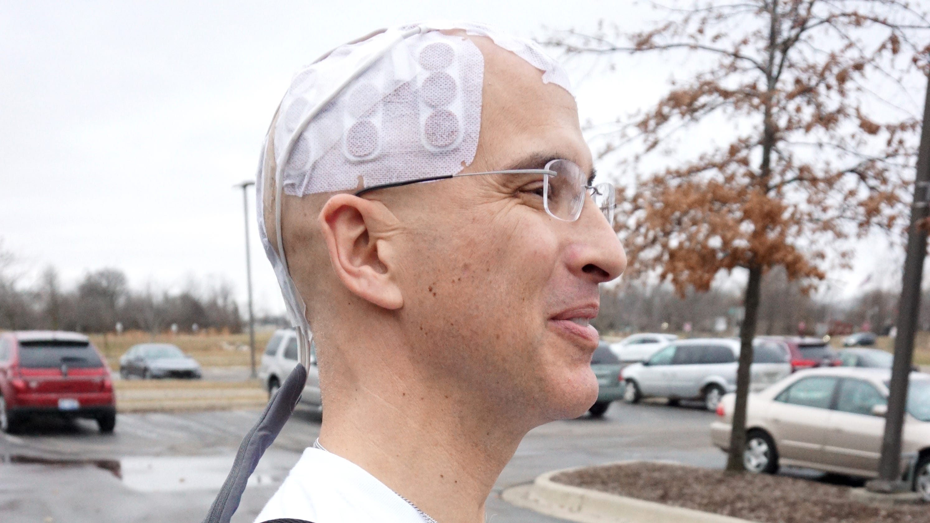 Canton man uses Optune to fight glioblastoma cancer