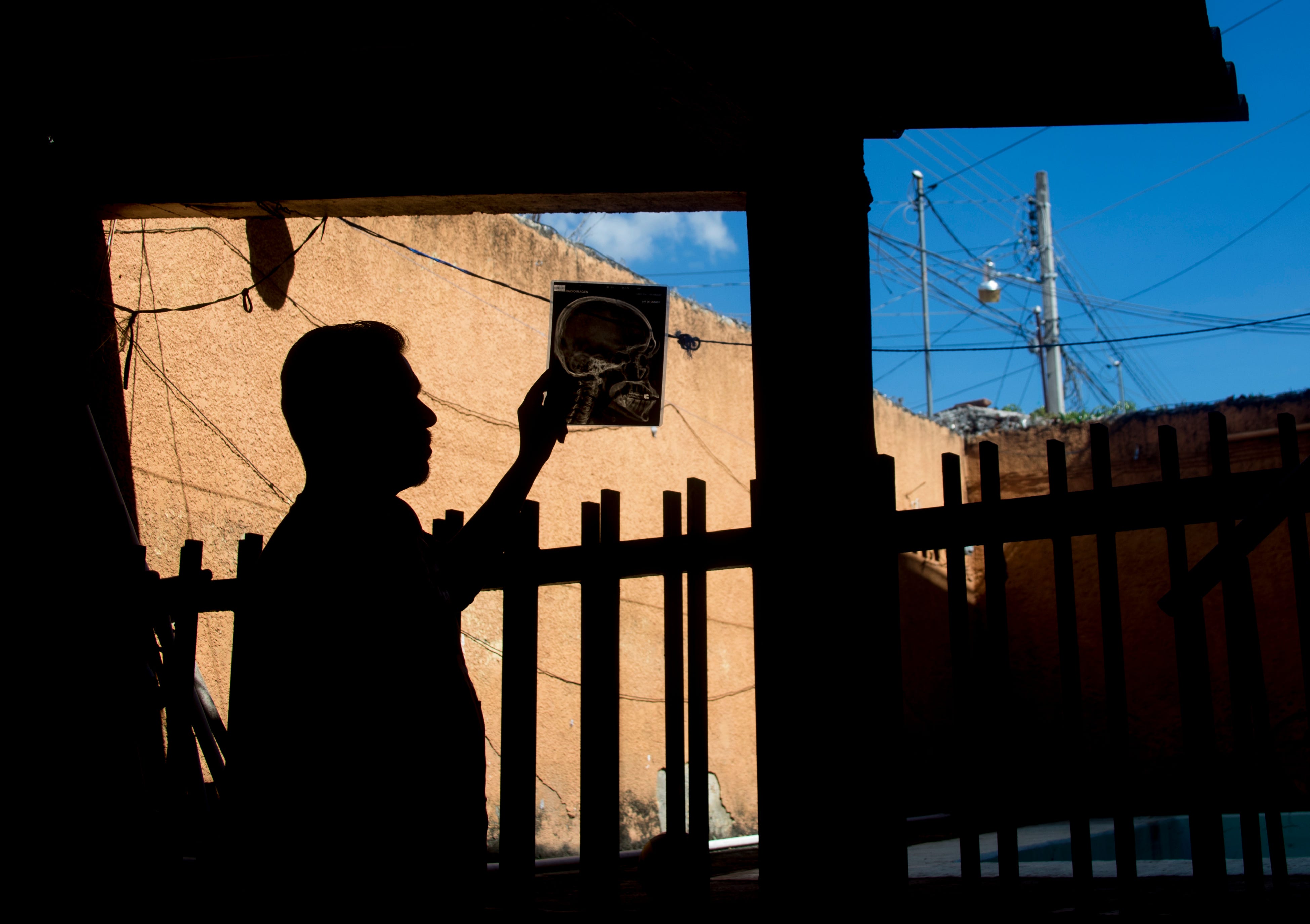 Jorge was extorted, kidnapped, beaten and left for dead after being deported back to Guerrero. He holds X-rays of the injuries he sustained in the beating.