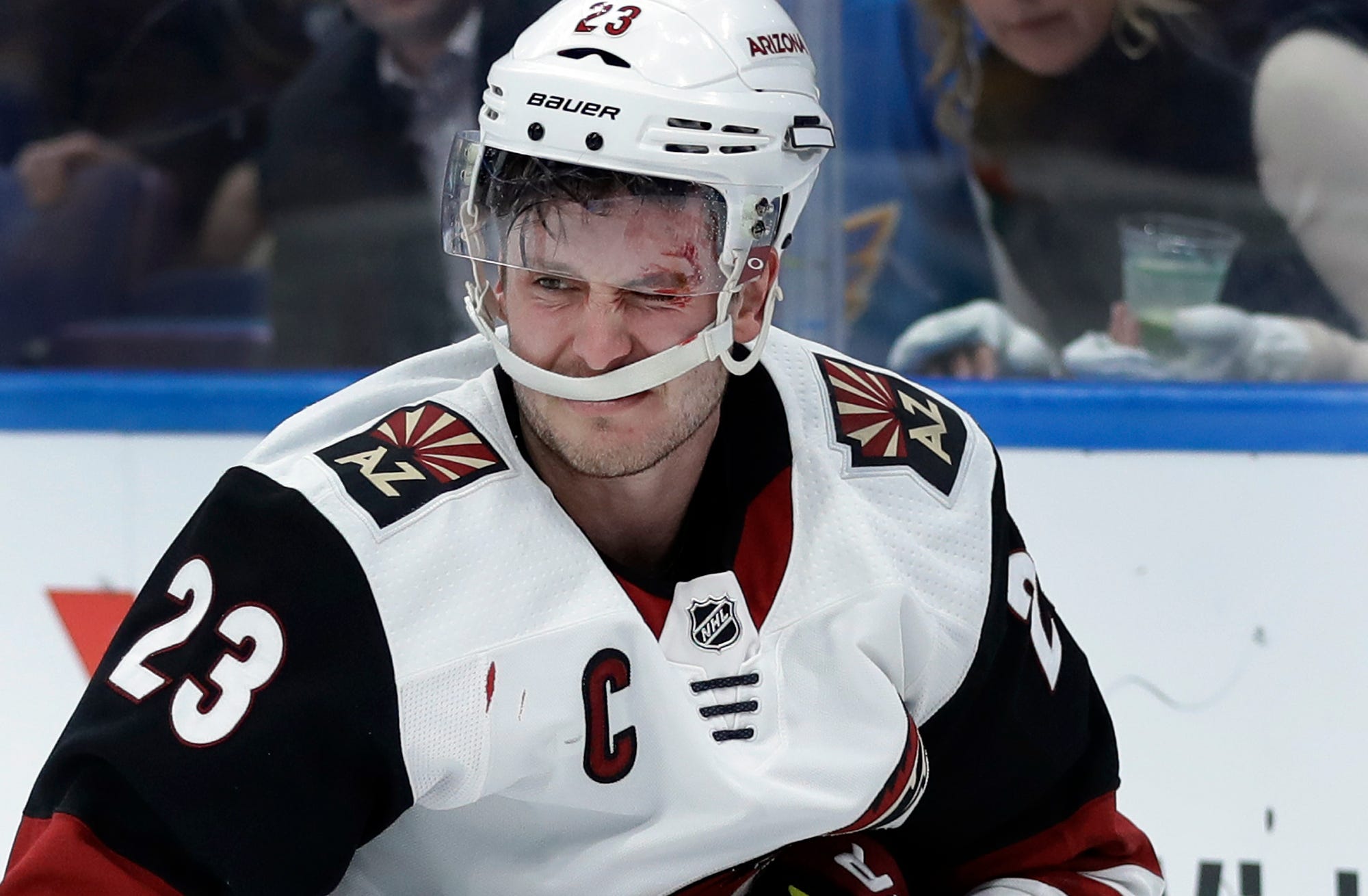 Coyotes captain Oliver Ekman-Larsson needed stitches after being attacked by family dog this summer