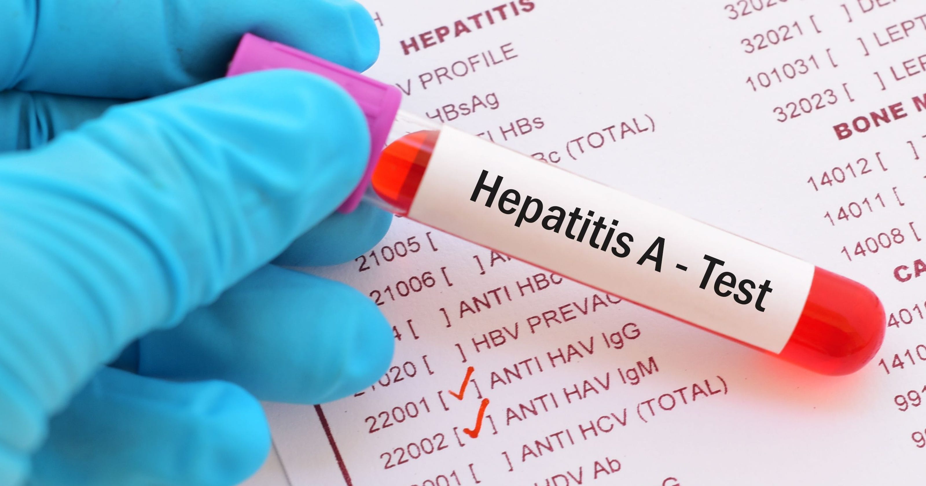 how is hepatitis a transmitted