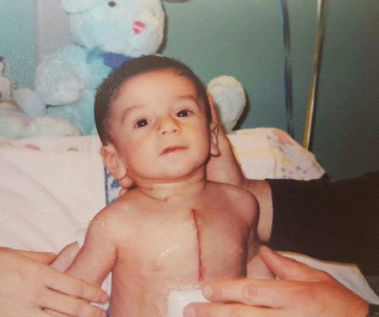 Brady Fisher following open heart surgery when he was 3 months old.