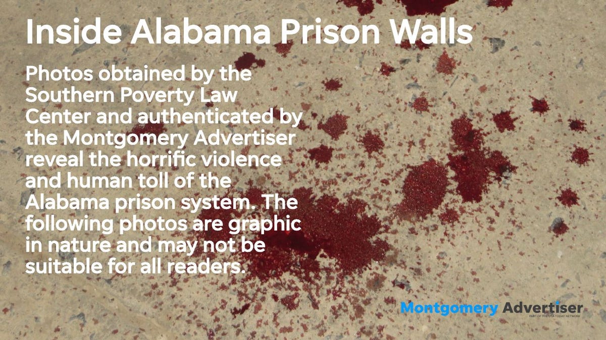 Bloody Alabama prison conditions revealed in leaked photos