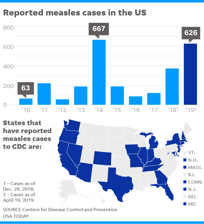 Measles United States 2024 Alyce Bernice