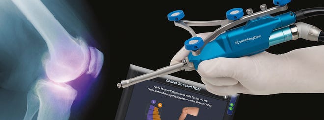 The NAVIO◊ platform is transforming joint replacements procedures.