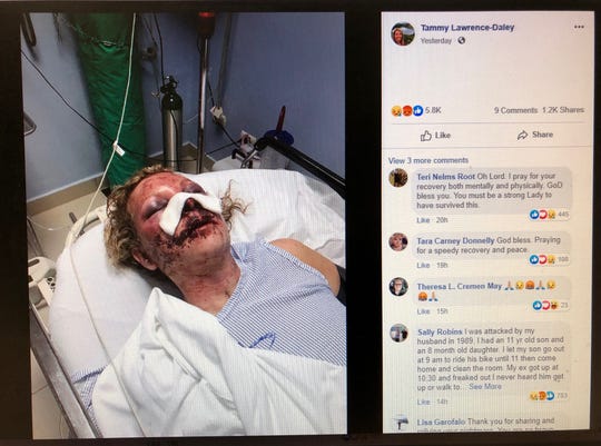 Tammy Lawrence-Daley shared this photo on Facebook as she recounted an attack that she says occurred while on a January vacation to the Dominican Republic.