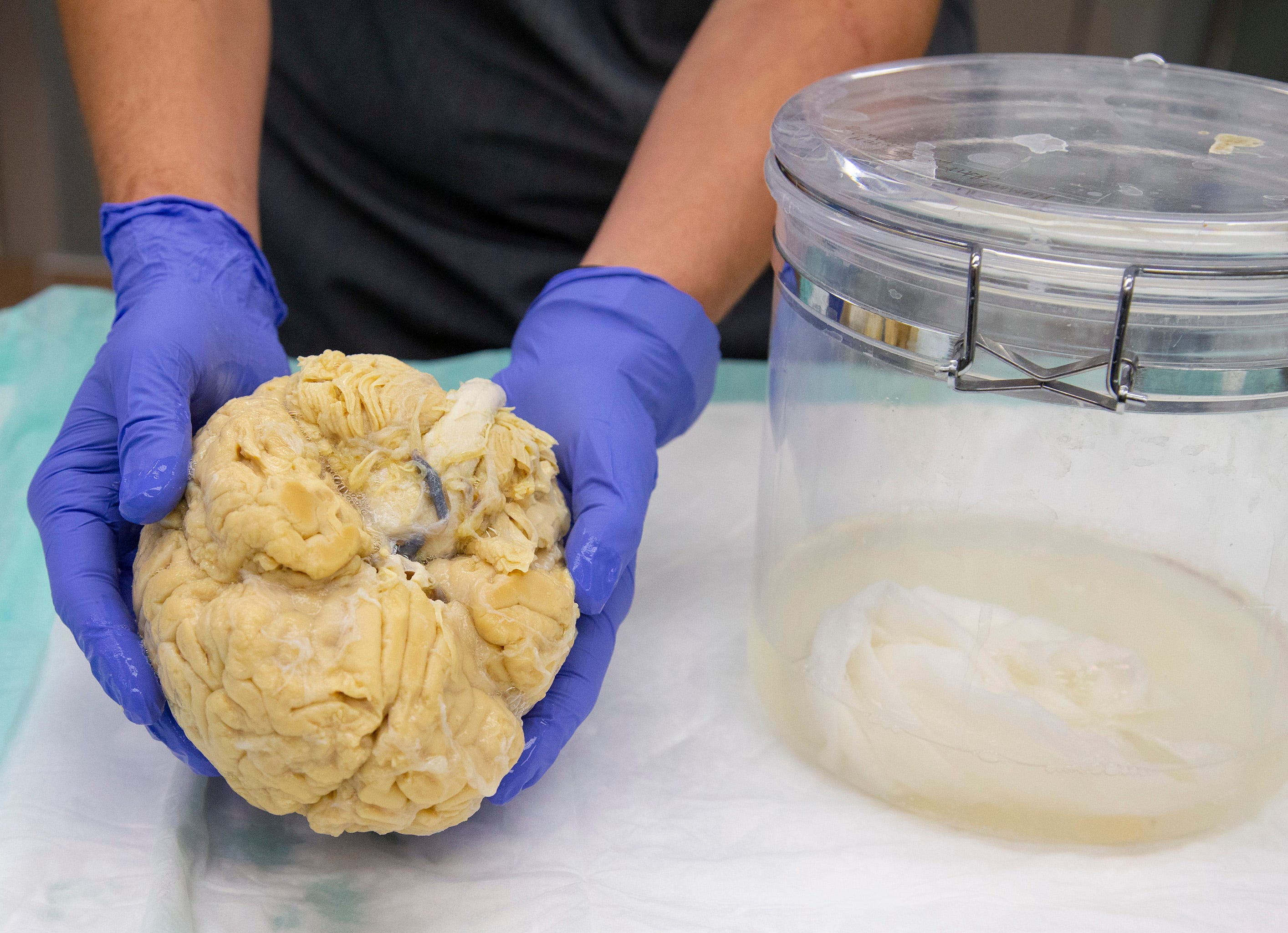Banner pathology tech Aryck Russell holds a donated brain.