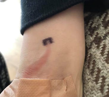 A British mother noticed this red trail in her son's arm and took her to a clinic on weekends. It turned out that he had sepsis.