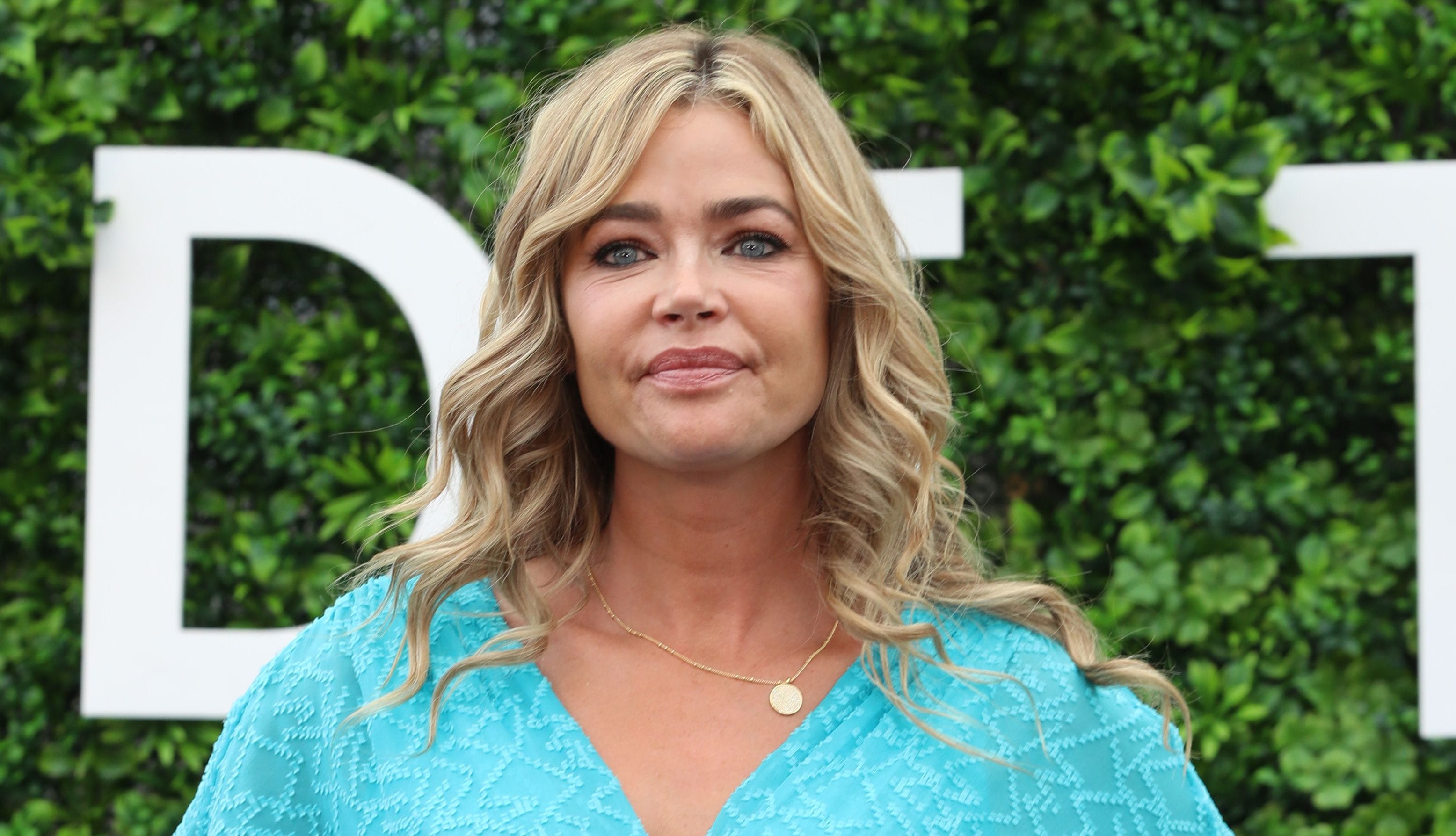 Denise Richards reveals emergency medical procedure after 4 hernias