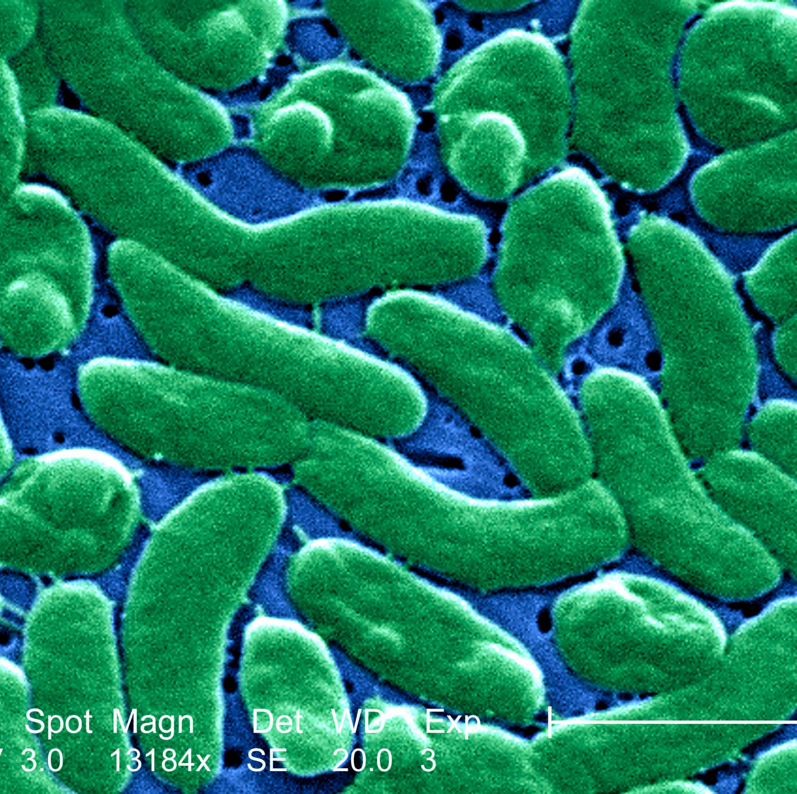 This scanning electron micrograph, SEM, depicts a grouping of Vibrio vulnificus bacteria; Magnified 13184x. Vibrio vulnificus is a bacterium in the same family as those that cause cholera. It normally lives in warm seawater and is part of a group of vibri