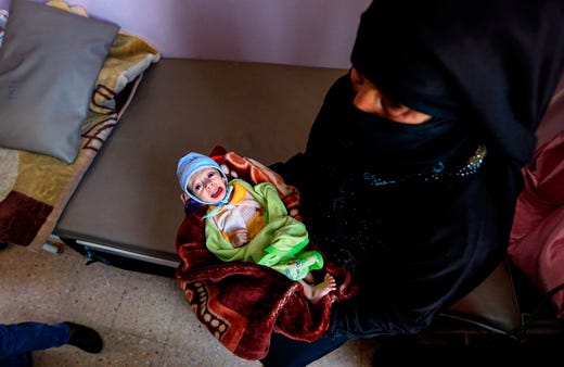 A child suffering from malnutrition lies in the lap of a woman at a treatment centre in al-Sabeen Maternal Hospital in the Huthi-rebel-held Yemeni capital Sanaa on June 22, 2019. Some Yemenis in Sanaa fear starvation after the World Food Program announced partial suspension of aid to the rebel-held capital. Citing problems with "diversion of food" from the neediest, the UN agency said on June 20 that it would initially only target Sanaa city, controlled by the Iran-aligned Huthis. The decision will affect 850,000 people. Nutrition programs will remain in place for malnourished children, pregnant women and nursing mothers.