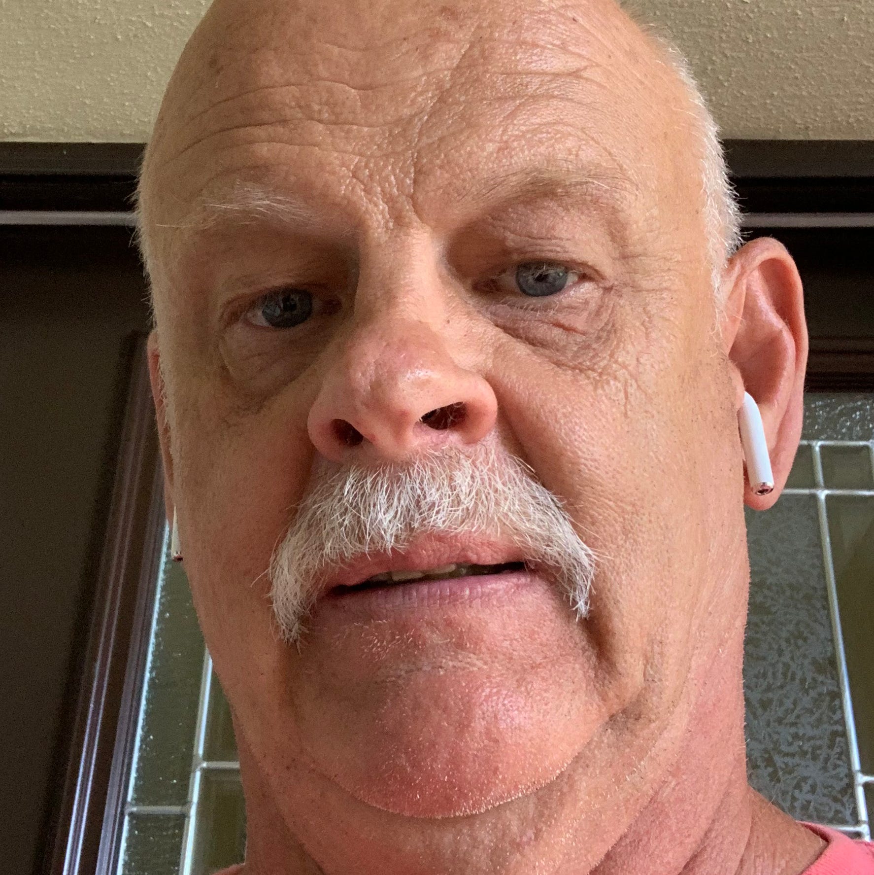 Philip Frincke of Venice, Florida is the owner of a 2014 Ford Focus. He took this photo on July 8 at home. He said, "I had more hair before this whole deal started back in 2014."