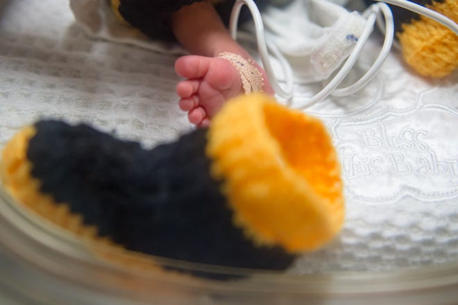 A new study suggests that babies born premature have fewer romantic relationships in adulthood than their full-term peers do.