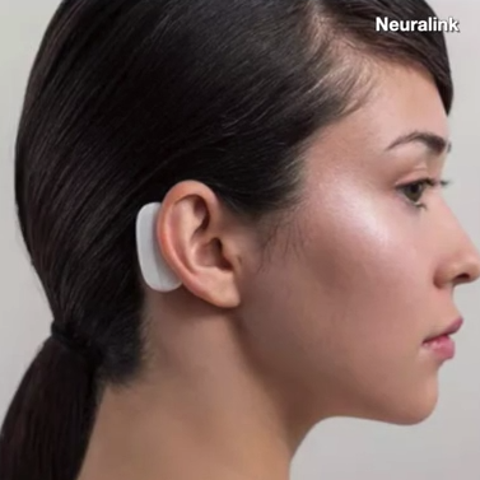 Elon Musk announced that his company Neuralink pla