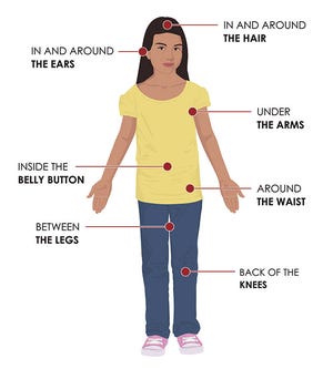 The Centers for Disease Control and Prevention offers this diagram for checking yourself -- or your child -- for ticks.
