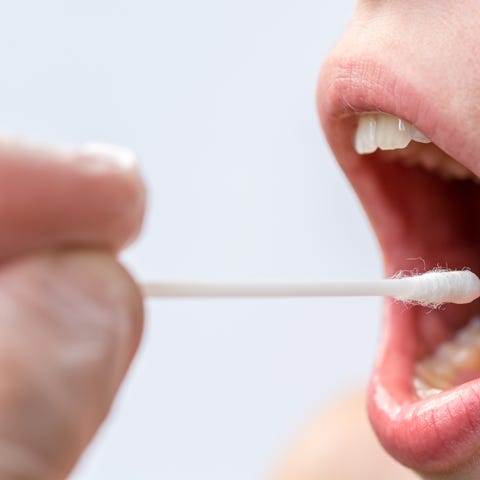 saliva sample