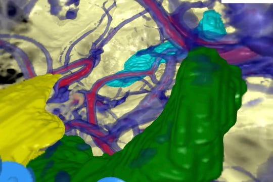 Screen grabs from the video of a tour of a human brain at Norton Children's Hospital utilizing their new Surgical Theater. 