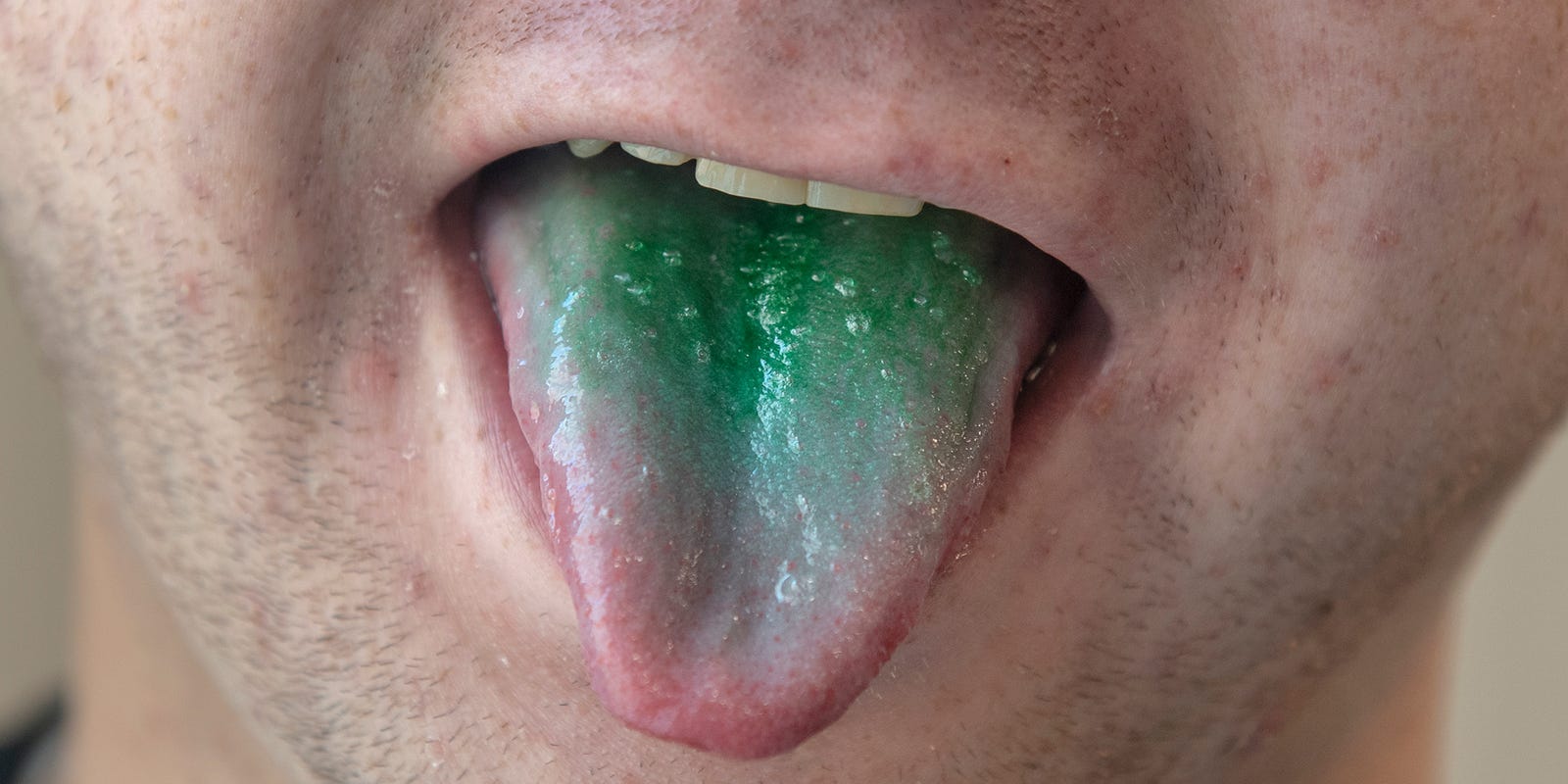 Dui Police Say People Who Smoke Weed Have Green Tongues
