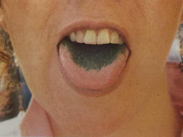 Dui Police Say People Who Smoke Weed Have Green Tongues Here's all you've ever needed to know about the effects of smoking marijuana, and how to keep your everyone has their preferred method of smoking weed.