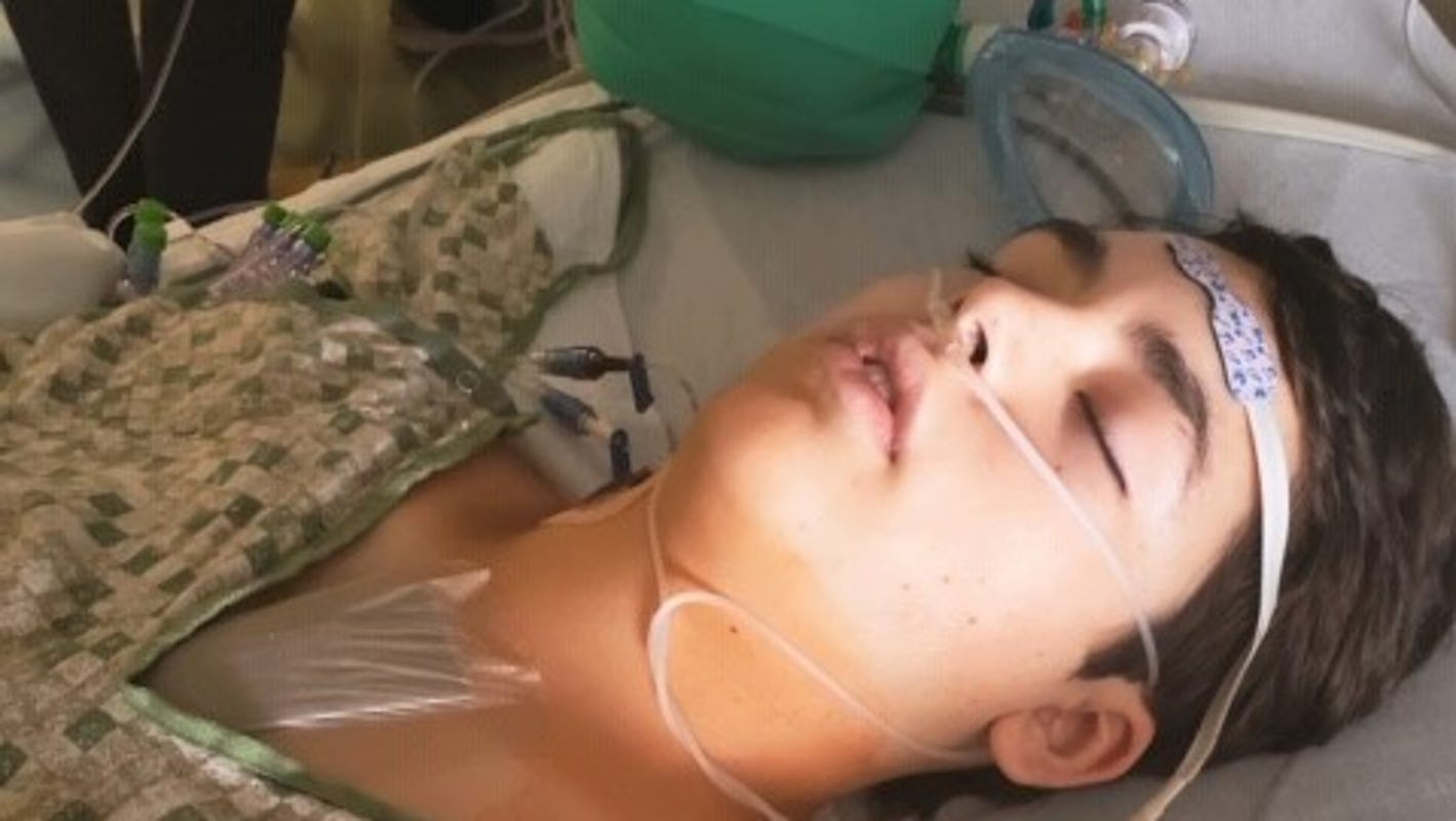 Alcapa Texas Teen Underwent Open Heart Surgery After Routine Physical