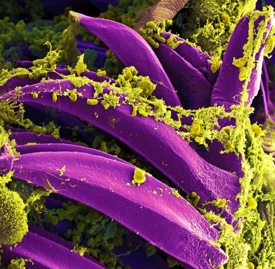 In this digitally colorized image from a scanning electron microscope, Yersinia pestis bacteria, shown in yellow, gathered inside a flea's digestive tract.  Yersinia pestis is the bacterium that that causes plague.
