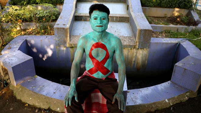 World Aids Day 2019 Faqs About Hiv Aids In The Us And Worldwide