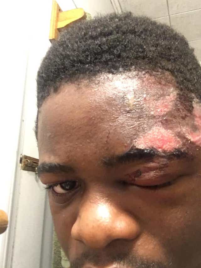 East Lansing Police Insufficient Evidence In Excessive Force Inquiry