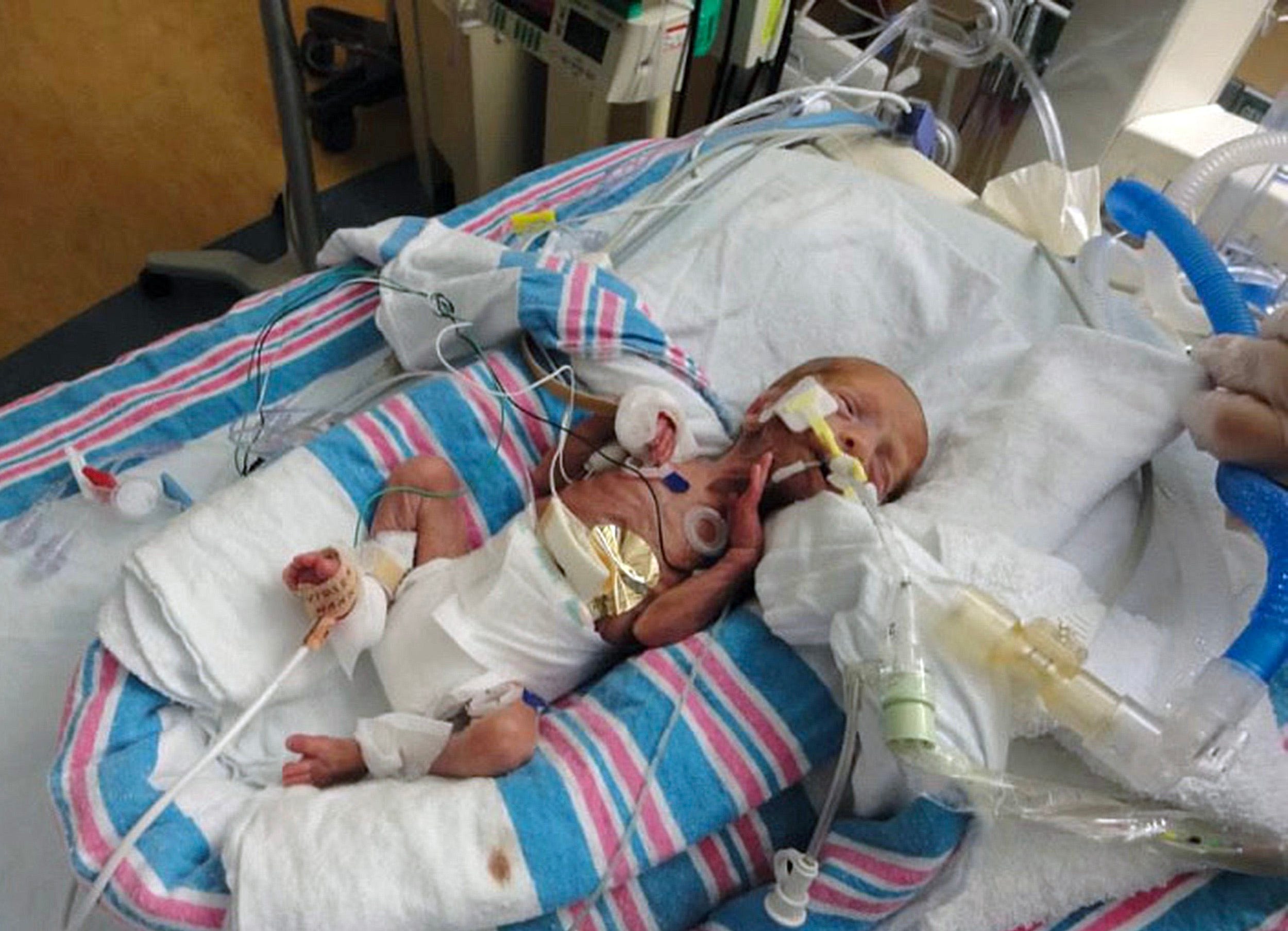 micro preemie twins