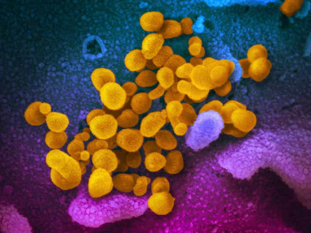 Michigan State University Of Michigan Have Covid 19 Cases
