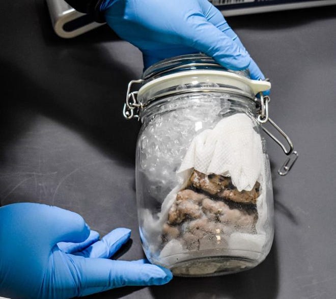 U.S. Customs and Border Protection agents found this brain in a jar on a mail truck at a checkpoint in Port Huron, Michigan. It lacked the proper documentation and was seized.