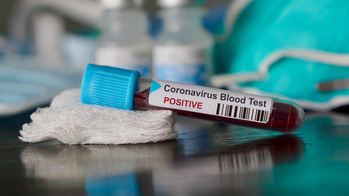 Interactive map shows coronavirus cases by zip code in Florida