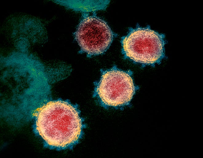 This undated electron microscope image made available by the U.S. National Institutes of Health in February 2020 shows the novel coronavirus that causes COVID-19. The sample was isolated from a patient in the U.S.