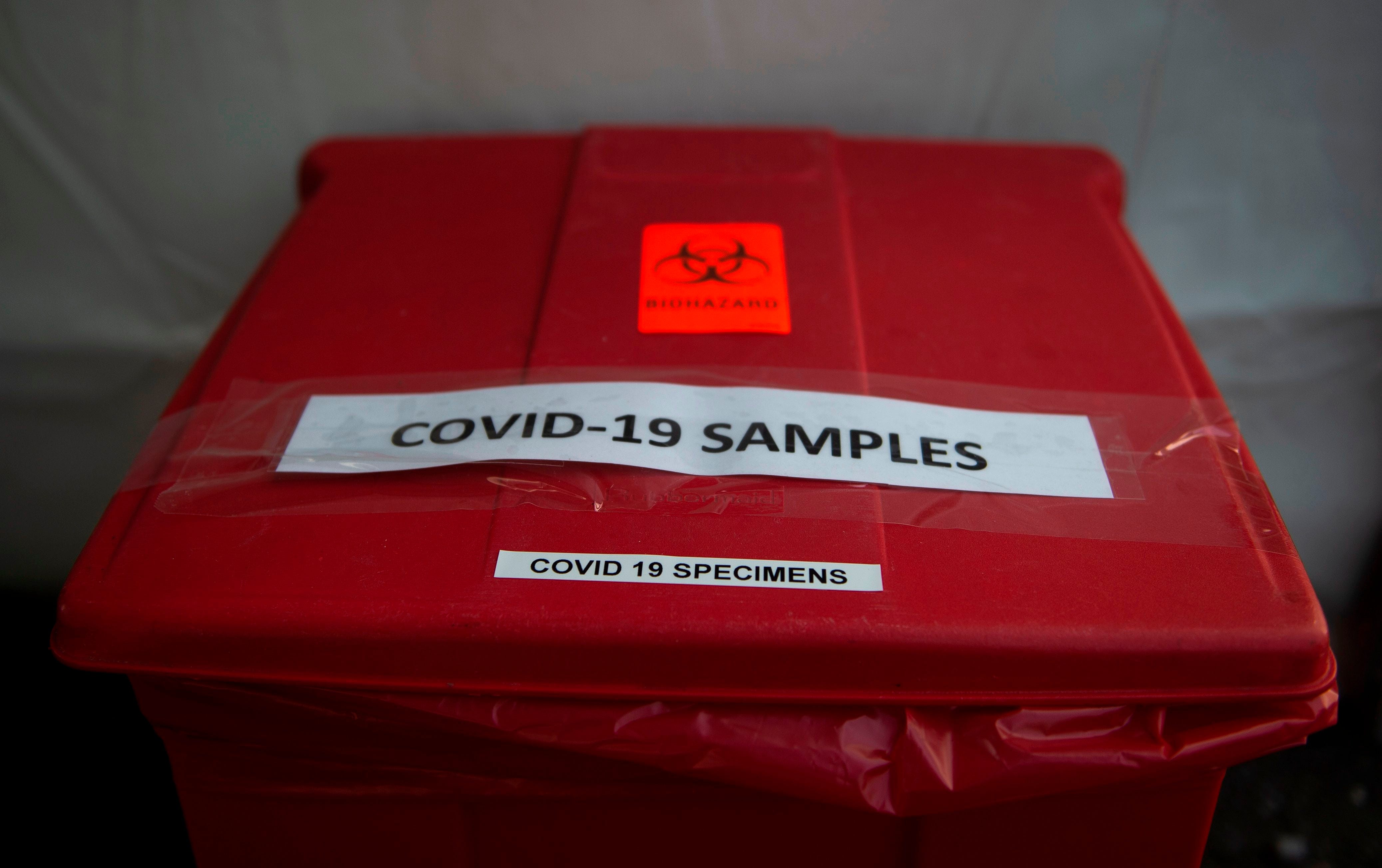 Take Coronavirus Precautions If A Housemate Has Symptoms Like A Cough