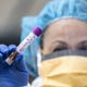 Medical assistant Mary Hermiz checks a sample from a patient at a Glendale drive-thru that tests for flu and coronavirus on March 25, 2020.  Medicare and some insurance plans will cover the testing (with normal co-pays and deductibles) or there is a $49 self-pay option. Experts say it's important to get a test inside the first 48 hours of symptoms starting.