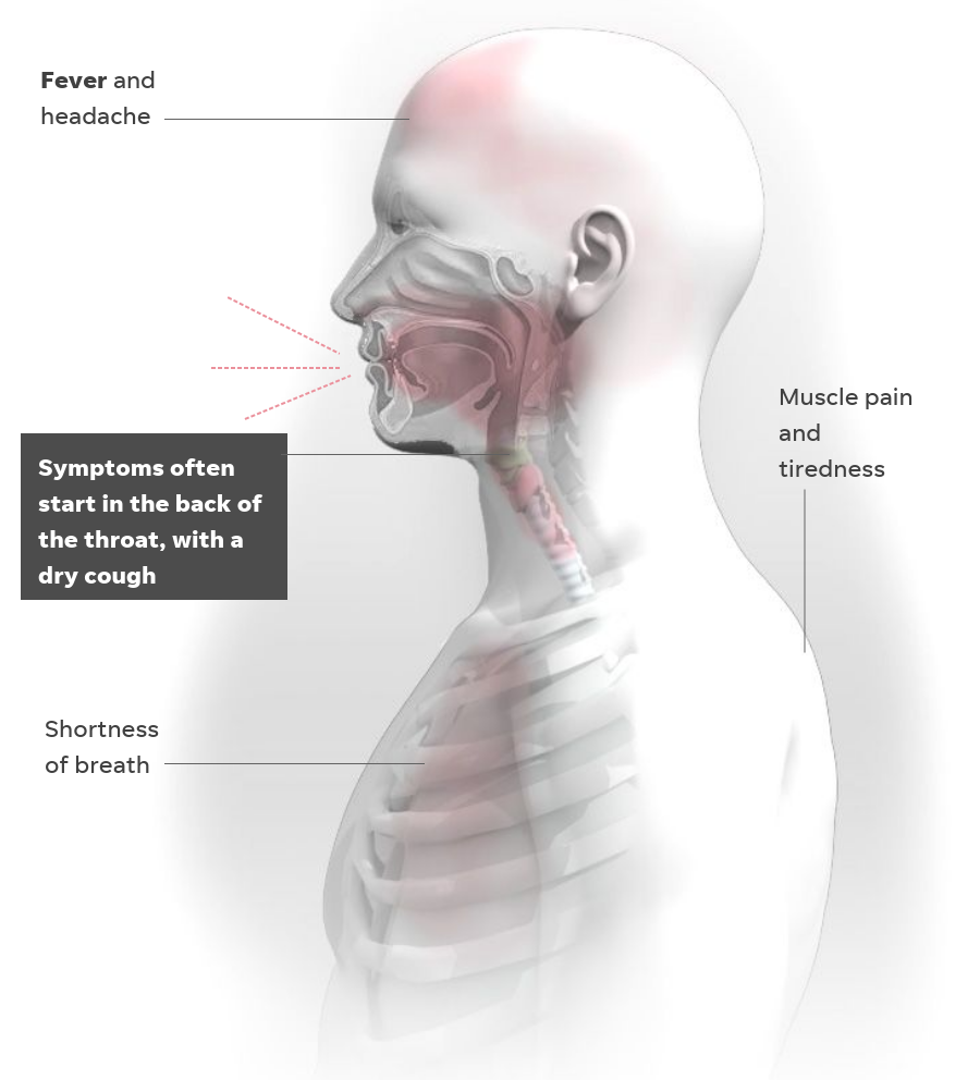 What Coronavirus Does To The Body Covid Infection Process Symptoms