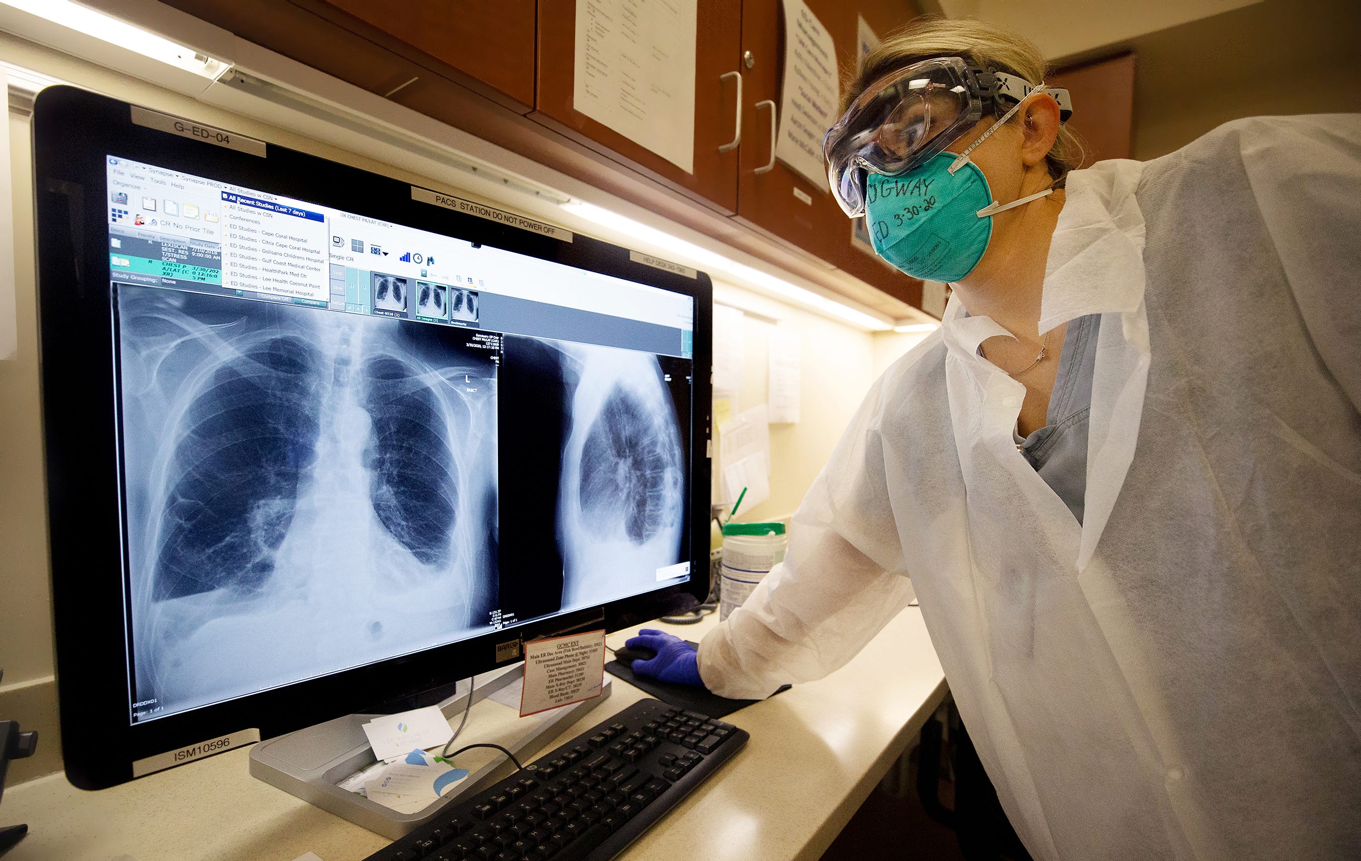 Physician assistant Allison Ridgway reads a COVID-19 patient's X-ray at Gulf Coast Medical Center in Fort Myers, Florida. (Note: Portions of this image have been edited to remove patient information)
