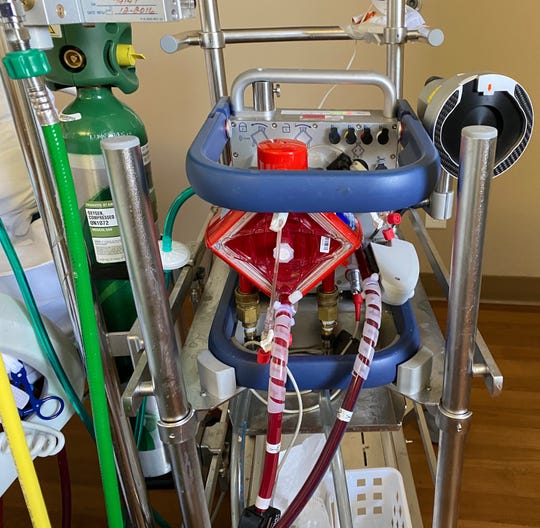 Arizona patient survives coronavirus with rare blood treatment ECMO