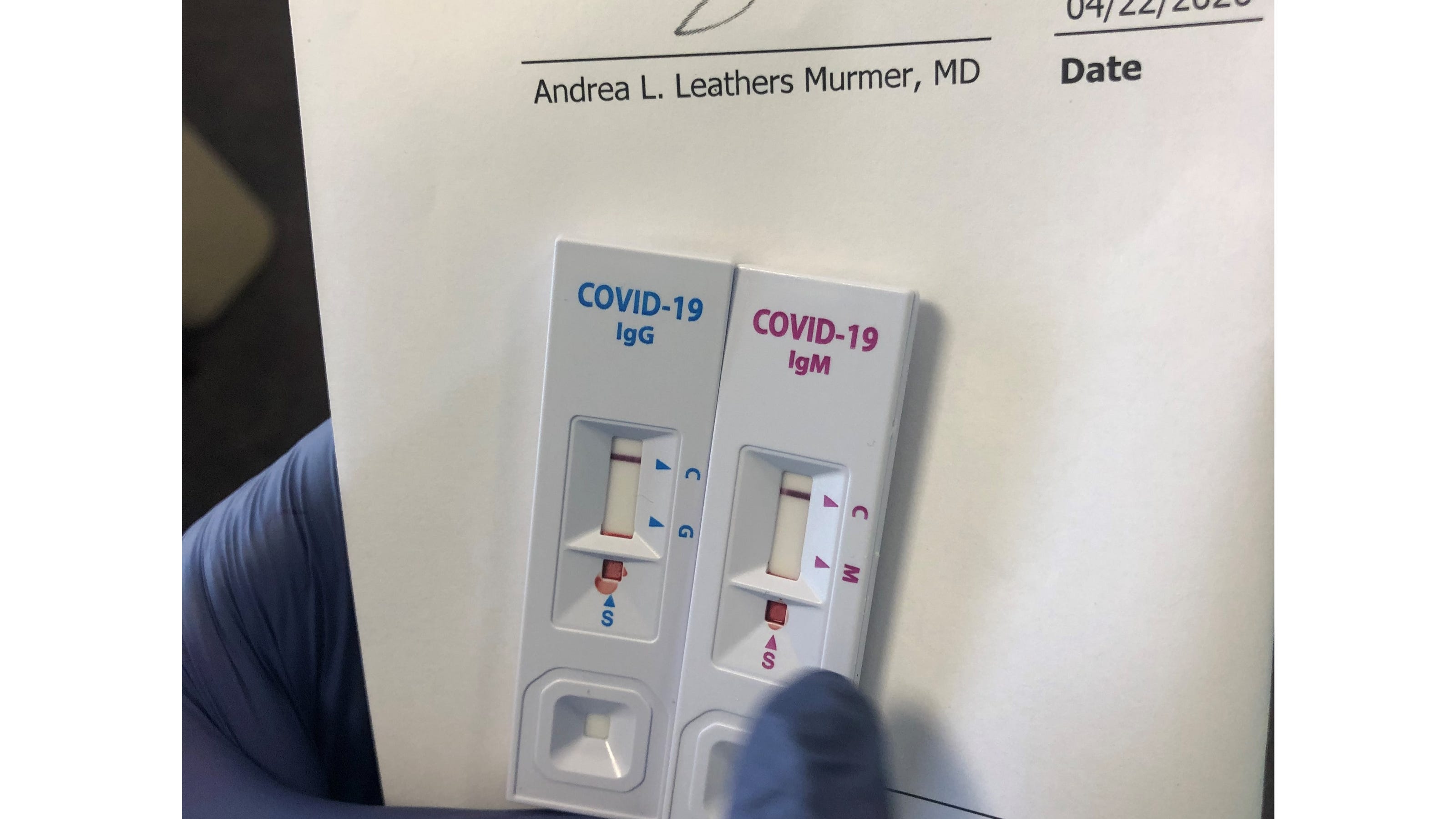 OMNI's COVID19 immunity testing data for Brevard shows 1 immunity