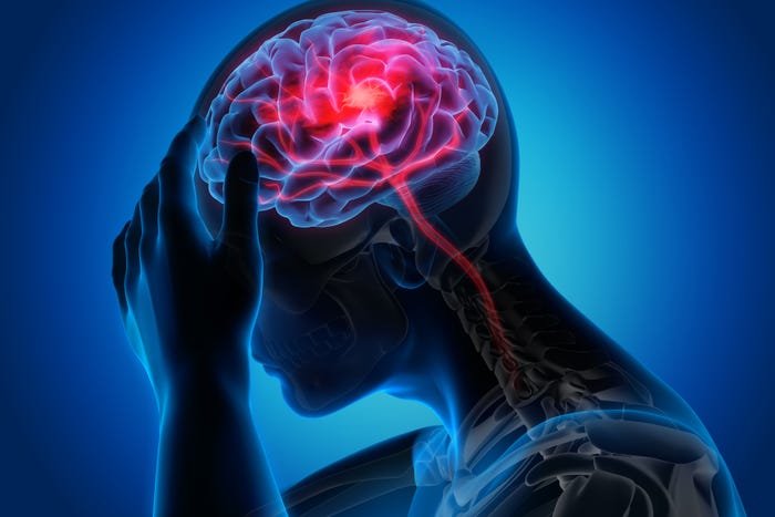COVID-19 may be linked to brain complications, study finds. But does it cause them?