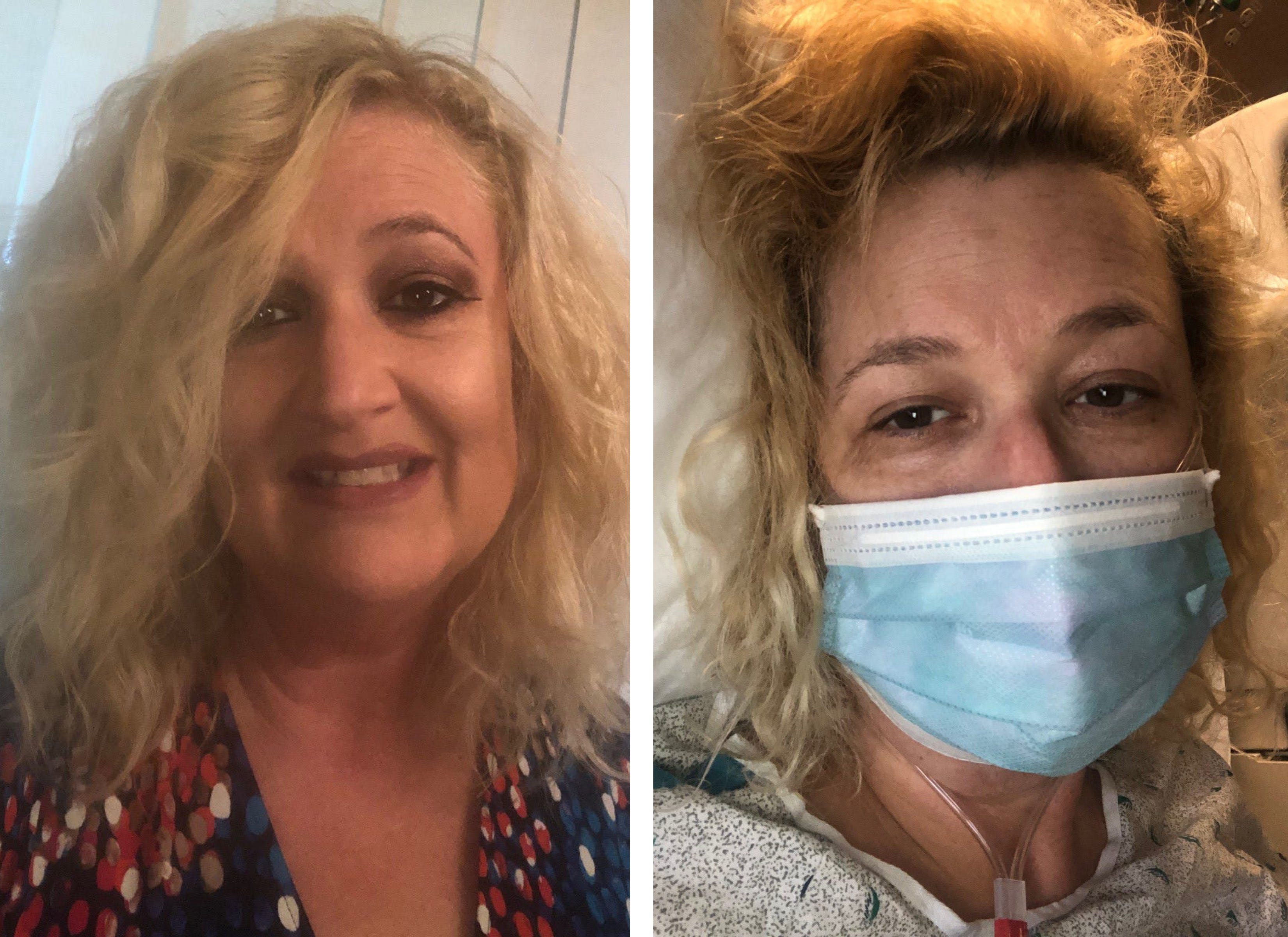 Wendy Lanski, 49, of West Orange, New Jersey, left, before contracting the coronavirus and, right, while hospitalized for the virus. Lanski, who also survived the 9/11 terror attacks in New York City, spent 13 days in a hospital battling the coronavirus. She still has lingering symptoms, like fatigue, headaches and a rapid heart rate, and wears a heart monitor to monitor her rate.