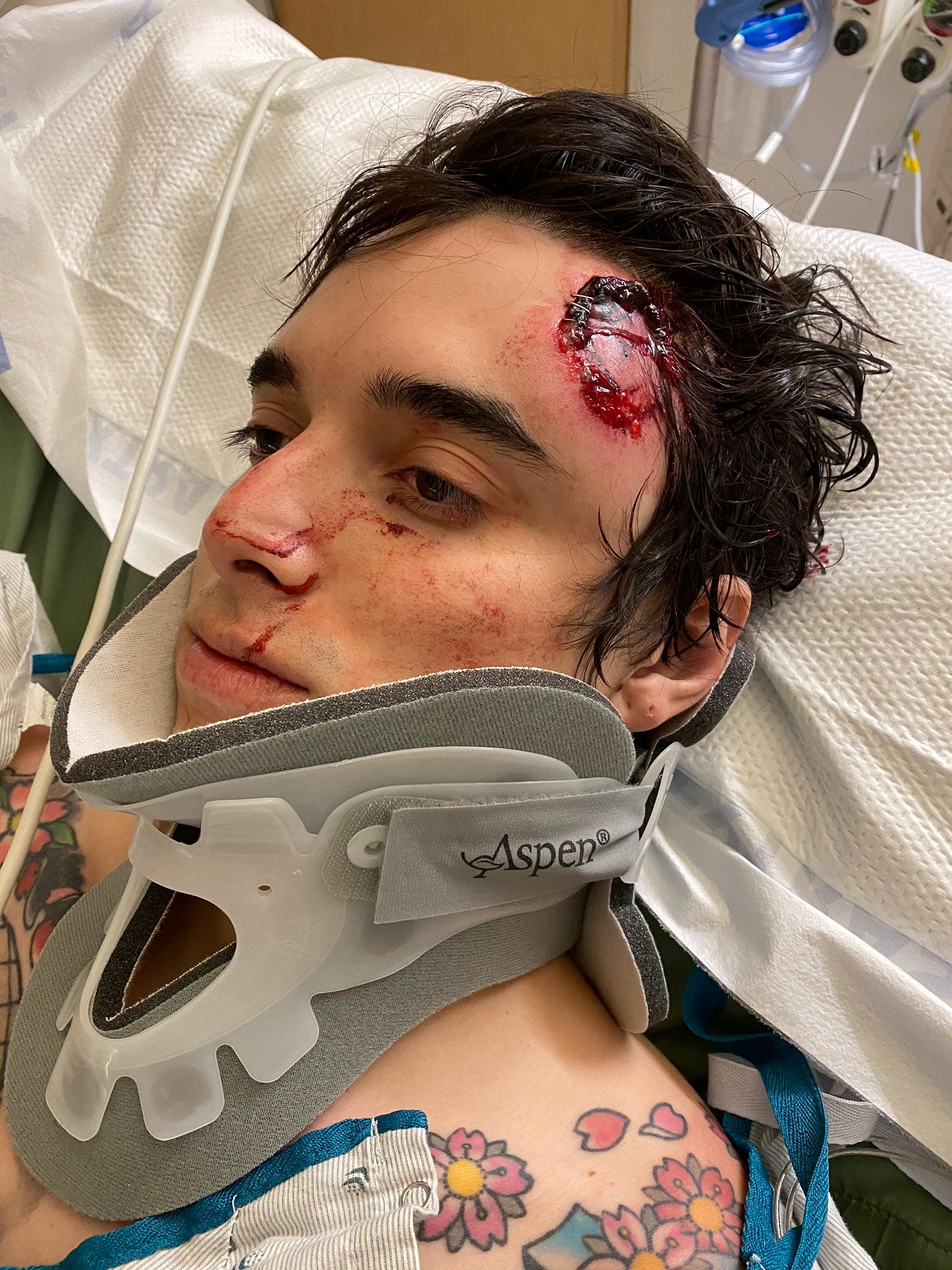 C.J. Montano, in the hospital after attending a Los Angeles protest, where the police shot a projectile at his head. The Marine was hospitalized in the intensive care unit due to bleeding in his brain. (Courtesy of CJ Montano)