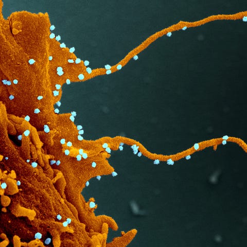 Electron microscopy image of cells from the kidney