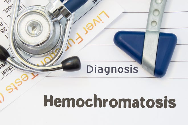 Hemochromatosis is a disorder where too much iron builds up in your body. Sometimes it's called “iron overload.”
