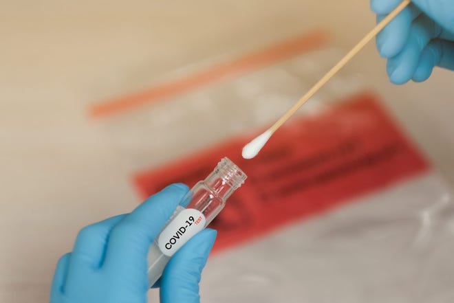 Virginia will receive 60,000 nasopharyngeal swabs weekly to support high-priority COVID-19 testing across the state, thanks to a collaboration led by University of Virginia faculty to design this key testing supply.